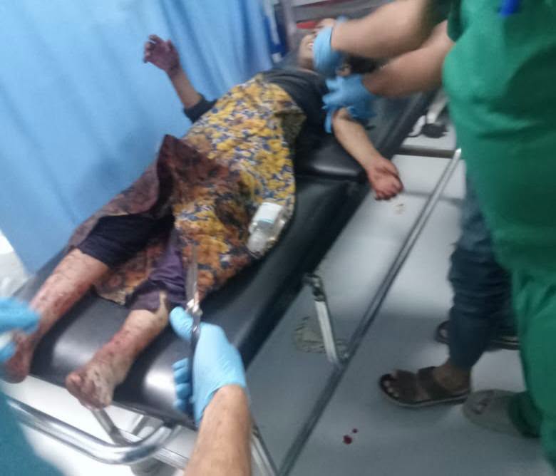 وزارة حقوق الإنسان تعلن ارتفاع ضحايا الجريمة الحوثية بحق أطفال الضالع إلى خمسة شهداء