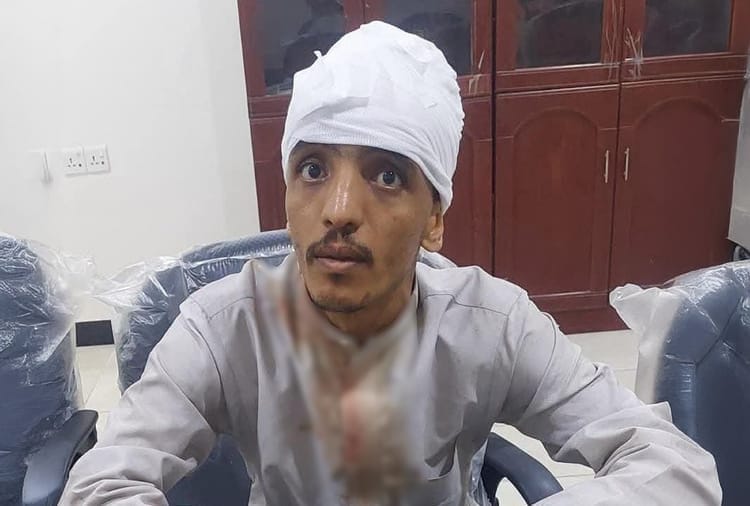 عناصر الانتقالي يعتدون على ناشط في عدن بتهمة العمل مع المهرية